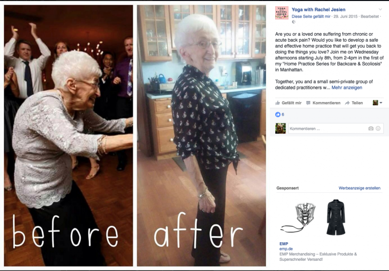 85χρονη γιαγιά με καμπούρα ξεκίνησε να κάνει γιόγκα...Θα πάθετε σοκ όταν δείτε πώς έγινε!