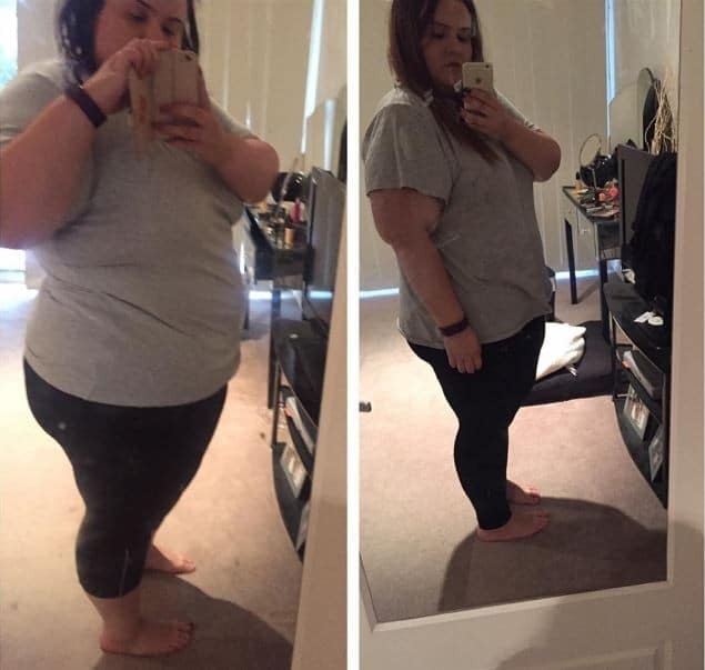 22χρονη έχασε 93 κιλά μέσα σε έναν χρόνο! Όταν δείτε πόσο αδυνάτισε θα μείνετε άναυδοι!
