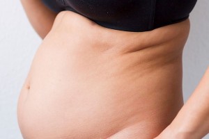 Λίπος στη κοιλιά! 5 ενδείξεις που δείχνουν ότι  οφείλεται σε ορμονική ανισορροπία