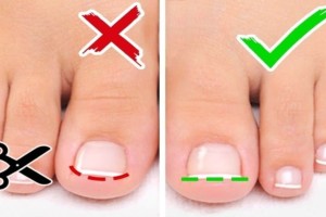 Αν κόβετε λάθος τα νύχια των ποδιών σας μπορεί να προκληθεί...: Μεγάλος κίνδυνος!