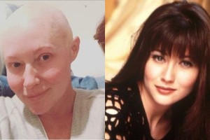 Σάνεν Ντόχερτι: Διαγνώστηκε με μεταστατικό καρκίνο στον εγκέφαλο η τηλεοπτική «Μπρέντα» του «Χτυποκάρδια στο Μπέβερλι Χιλς»