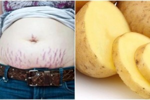 «Καλλυντικό» οι πατάτες: Το μυστικό ομορφιάς για να απαλλαγείτε από τις ραγάδες μια για πάντα!