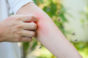 H βιταμίνη που σας λείπει και σας τσιμπάνε τα κουνούπια: Τι να τρώτε για να την αναπληρώσετε