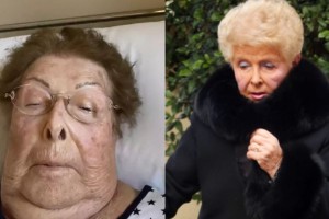 Κατάθεση ψυχής από την 90χρονη Βέφα Αλεξιάδου: «Ο πόνος μου θα σταματήσει όταν κλείσω τα μάτια μου» (video)