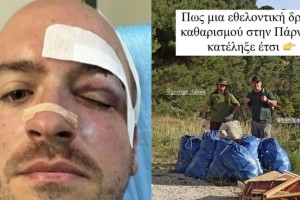 Άγρια επίθεση στην Πάρνηθα: Νεαροί μαχαίρωσαν εθελοντές που καθάριζαν την περιοχή - «Εμείς είμαστε από το Μενίδι» φώναζαν