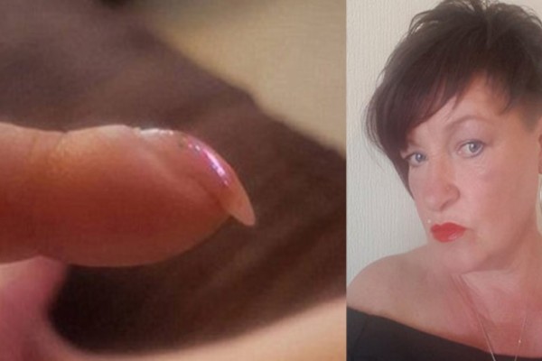 53χρονη ανακάλυψε ότι έχει καρκίνο από φωτογραφία των νυχιών της που ανέβασε στο ίντερνετ