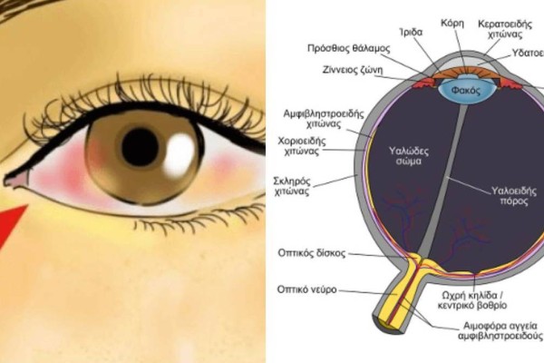 Αποκόλληση αμφιβληστροειδούς: Αν έχετε αυτά τα σημάδια τρέξτε αμέσως στον γιατρό!