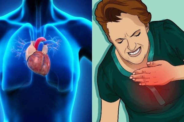 Αυτή είναι η διαφορά καρδιακής προσβολής και εμφράγματος - Πώς θα σώσετε τον εαυτό σας