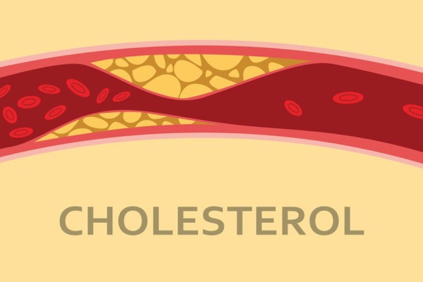 Χοληστερίνη: Τα ανησυχητικά σημάδια και πως να την αντιμετωπίσετε