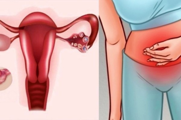 Τρέξτε άμεσα στο γιατρό: Το σύμπτωμα που «προδίδει» καρκίνο στις ωοθήκες
