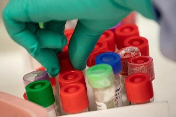 Κορωνοϊός: Νέα ανακάλυψη με γονίδιο που ενδέχεται να αυξάνει τον κίνδυνο θανάτου - Ποιοι το έχουν