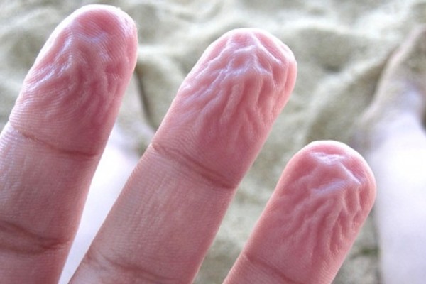 Εσείς γνωρίζετε το λόγο που τα δάχτυλα «μουλιάζουν» στο νερό;