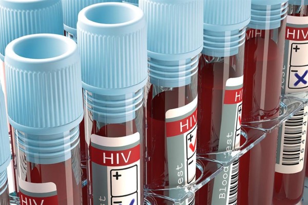 Τρόμος στην Ευρώπη με τον HIV: Εντοπίστηκε νέα πιο μεταδοτική και παθογόνα μετάλλαξη