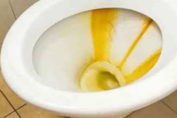 Εύκολος τρόπος για να αφαιρέσετε την κιτρινίλα από την λεκάνη της τουαλέτας