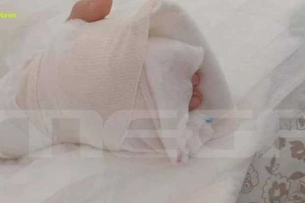 Εφιάλτης σε παιδική χαρά στη Θεσσαλονίκη: Αποκολλήθηκε το δάχτυλό 8χρονης - Συγκλονίζει η μητέρα