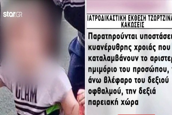 Νεκρά παιδιά στην Πάτρα: Σημάδια σοκ στο πρόσωπο της Τζωρτζίνας - Ολόκληρη η ιατροδικαστική έκθεση για την 9χρονη (Video)