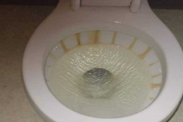«Πονοκεφαλιάζει» η σκουριά στη λεκάνη της τουαλέτας - Με αυτό το υλικό του μπάνιου θα την καταπολεμήσετε!