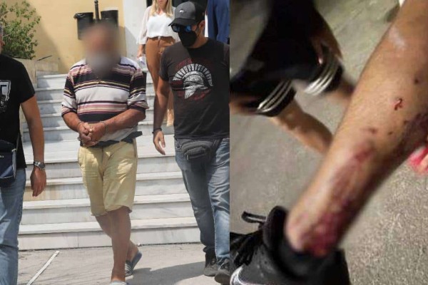 Αλεποχώρι: Φωτογραφίες ντοκουμέντο από τα τραύματα του 14χρονου που δέχθηκε πυρά από τον 70χρονο