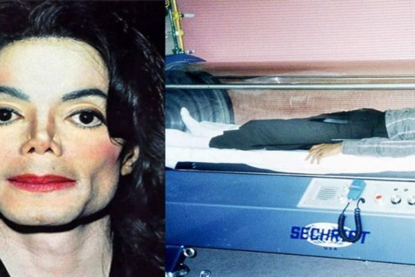 Στο φως ανατριχιαστικά στοιχεία από τη νεκροψία του Μάικλ Τζάκσον - Το σώμα του ήταν γεμάτο... (photo)