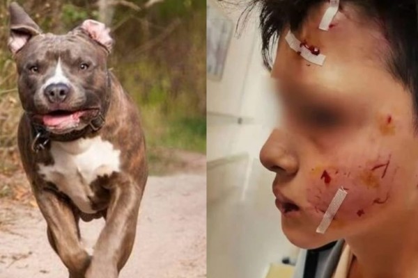 Λαγονήσι: «Εάν δεν ήμουν εκεί, θα το έτρωγε το παιδάκι», είπε ο άνδρας που έσωσε τον 13χρονο από επίθεση σκύλου