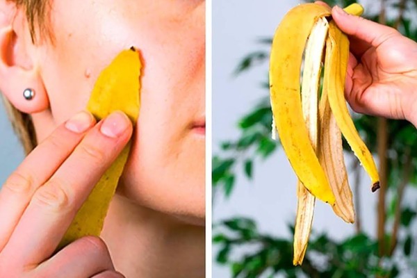 Φλούδα μπανάνας: Πως να τη χρησιμοποιήσετε για να λύσετε καθημερινά προβλήματα και να γλυτώσετε χρήματα
