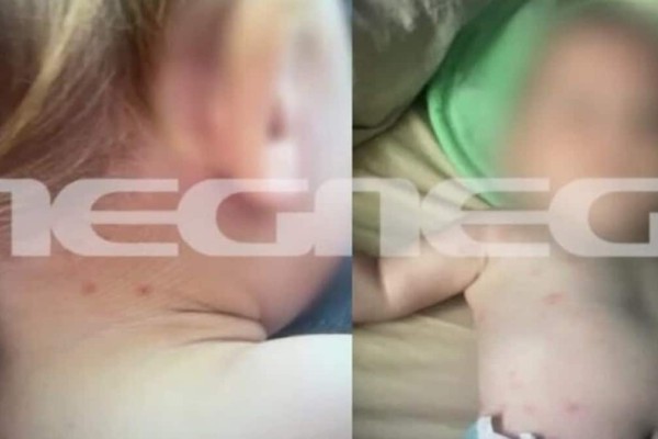 Έγκλημα στην Καβάλα - Αποτροπιαστικό ντοκουμέντο: Εικόνες-σοκ με σημαδεμένο το κορμάκι του μωρού από τα τσιμπήματα ψύλλων (video)
