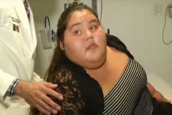Μπήκε στο χειρουργείο ως η πιο παχύσαρκη έφηβη του κόσμου, 9 μήνες αργότερα... Δείτε πως έγινε και θα τρίβετε τα μάτια σας!