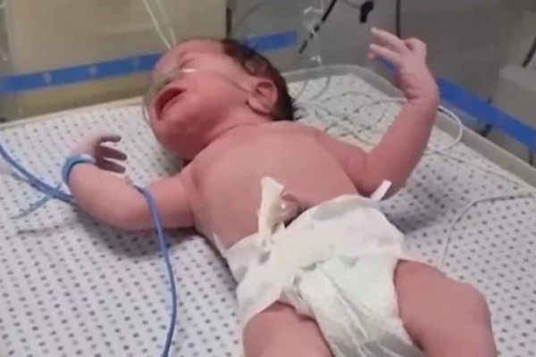 Το θαύμα της ζωής: Παλαιστίνια γέννησε ένα υγιέστατο μωρό αφότου βομβαρδίστηκε το σπίτι της