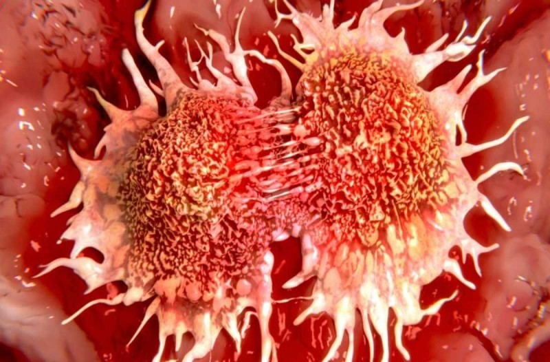 Χρόνιο νόσημα και όχι θανατηφόρο ο καρκίνος - Τι ανακοίνωσαν οι ειδικοί