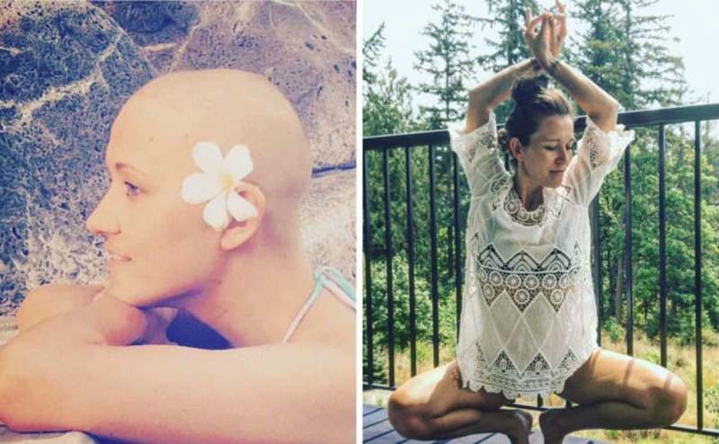 καρκίνος πριν και μετά