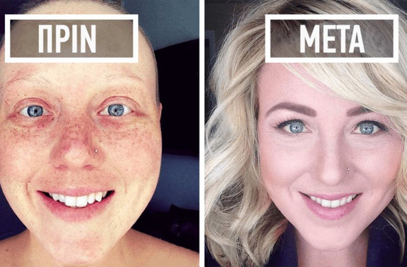 8 φωτογραφίες ανθρώπων που νίκησαν τον καρκίνο - Το πριν και το μετά