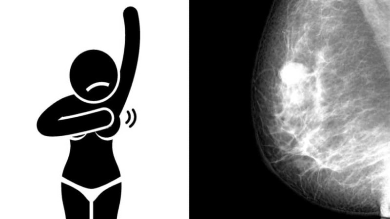 Αυτά είναι τα συμπτώματα του καρκίνου του μαστού που καμία γυναίκα δεν πρέπει να τα αγνοήσει (video)