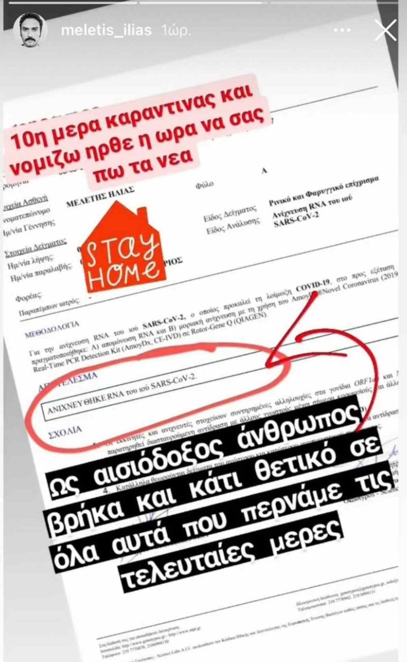 Θετικός στον κορωνοϊό ο ηθοποιός.