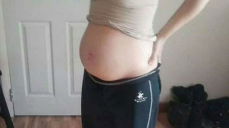 Έγκυος έβγαλε αυτή τη φωτογραφία και τη δημοσίευσε στο facebook - Αμέσως η αστυνομία άρχισε να την αναζητά
