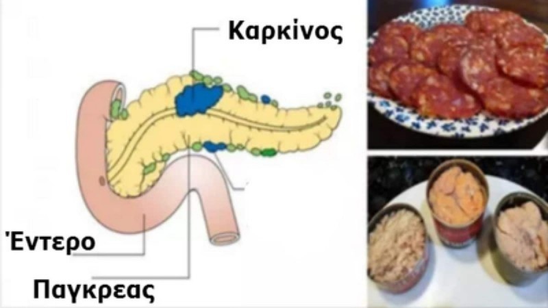 9+1 καρκινογόνες τροφές που μας φέρνουν πιο κοντά στο θάνατο