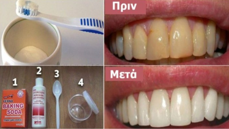 Αποκτήσετε κάτασπρα δόντια και απαλλαγείτε από την πλάκα τα χωρίς να ξοδέψετε χρήματα