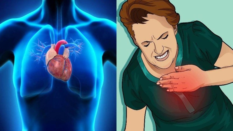 Αυτή είναι η διαφορά καρδιακής προσβολής και εμφράγματος - Πώς θα σώσετε τον εαυτό σας