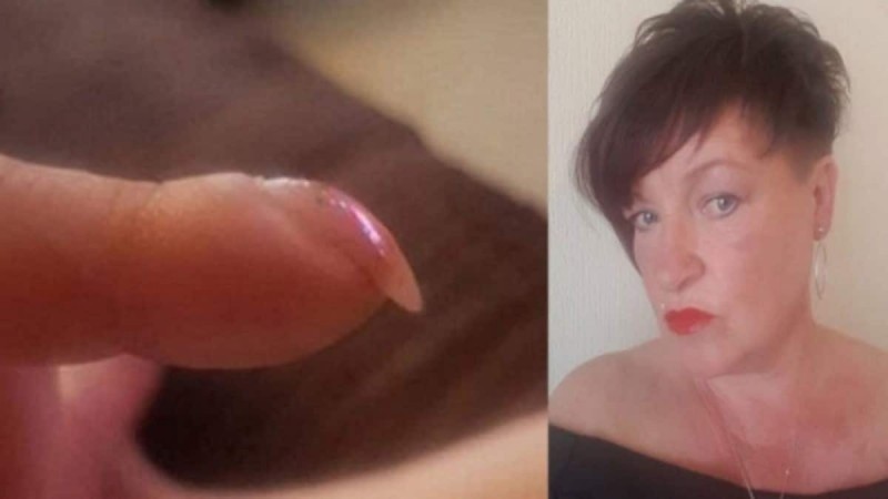 Απίστευτο: 53χρονη ανακάλυψε ότι έχει καρκίνο από φωτογραφία των νυχιών της που ανέβασε στο ίντερνετ