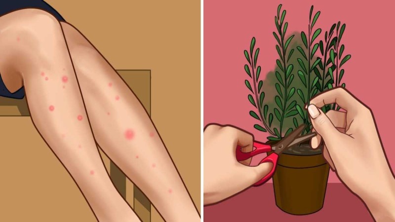 Όλα όσα πρέπει να γνωρίζετε για τα κουνούπια και πώς να τα κρατήσετε μακριά σας αυτό το καλοκαίρι