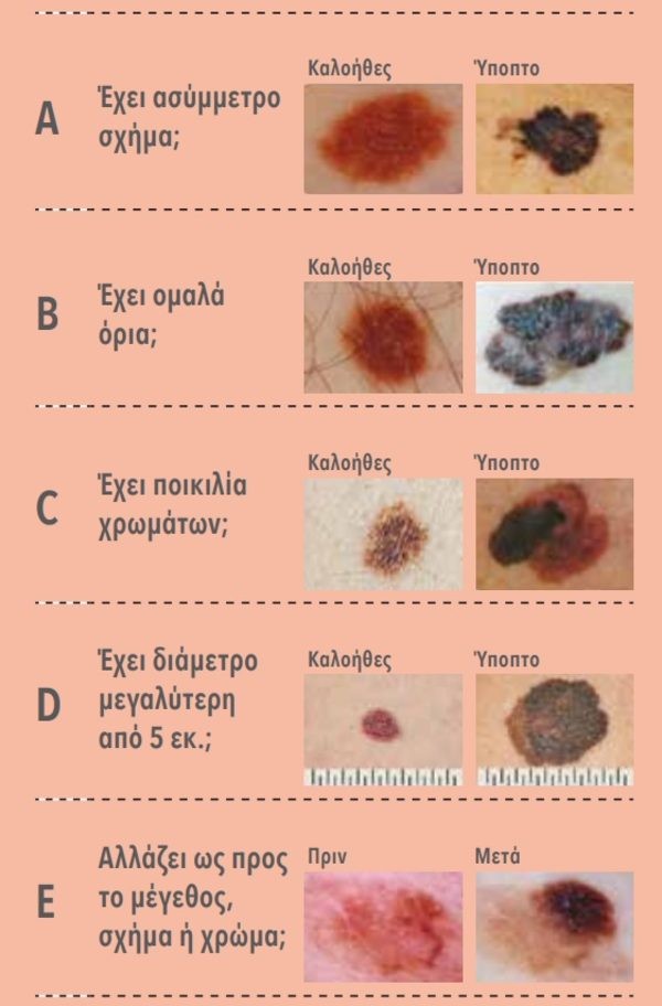 Μεγάλη προσοχή αν δείτε τέτοια σημάδια στο δέρμα σας! - Τι να κάνετε