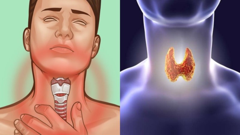 Μην τις ξαναβάλετε στο στόμα σας: 6+1 τροφές που προκαλούν καρκίνο του θυρεοειδούς
