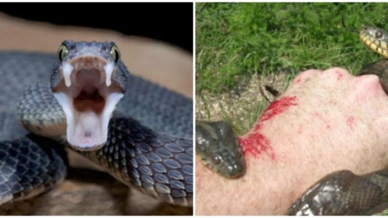 Σώζει ζωές! Αυτά πρέπει να κάνετε αν σας δαγκώσει φίδι!