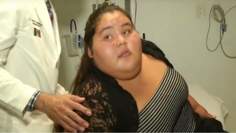 15χρονη μπήκε στο χειρουργείο ως η πιο παχύσαρκη έφηβη του κόσμου. 9 μήνες αργότερα... Δείτε πως έγινε και θα τρίβετε τα μάτια σας (Video)