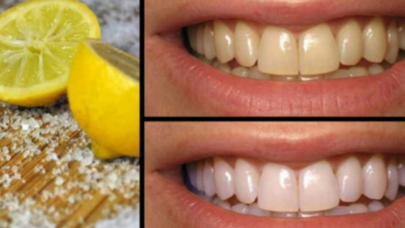Λεμόνι το θαυματουργό: 2 τρόποι για να αντιμετωπίσετε όλα τα προβλήματα με τα δόντια σας