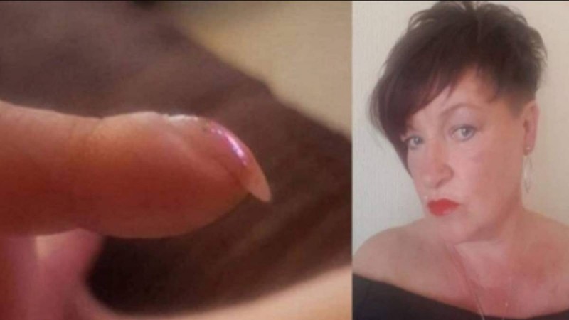 53χρονη ανακάλυψε ότι έχει καρκίνο από φωτογραφία των νυχιών της που ανέβασε στο ίντερνετ
