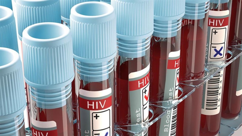 Τρόμος στην Ευρώπη με τον HIV: Εντοπίστηκε νέα πιο μεταδοτική και παθογόνα μετάλλαξη