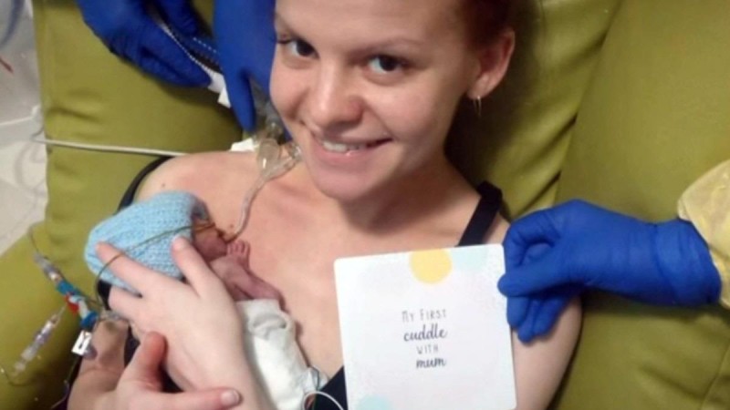 Μικρός ήρωας: Πρόωρο μωρό 23 εβδομάδων έδωσε μάχη και επέζησε μετά από 8 χειρουργεία  	 