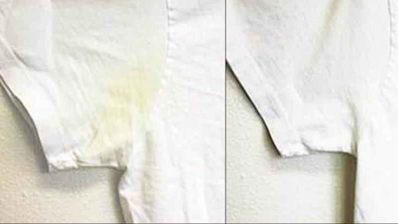 Αυγό το θαυματουργό: Διώχνει τις κιτρινίλες απ' τα λευκά ρούχα - Δείτε πώς
