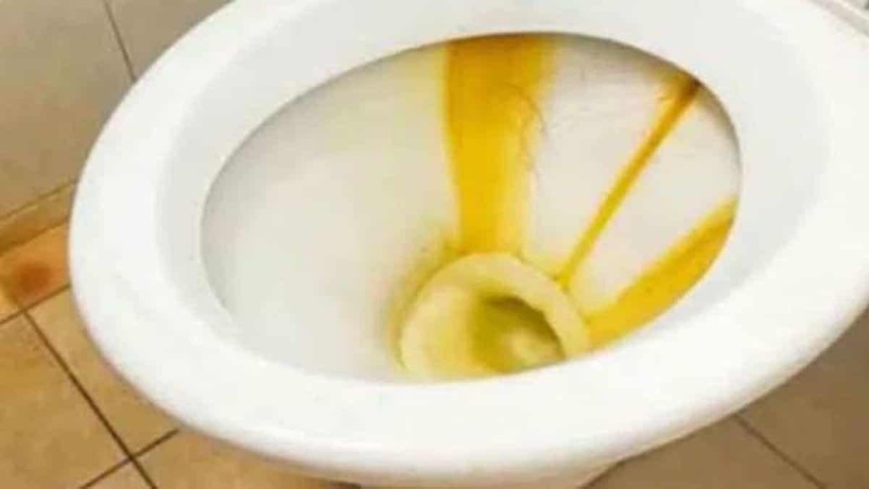Κιτρινίλα στη λεκάνη της τουαλέτας; Ο εύκολος τρόπος για να την αφαιρέσετε