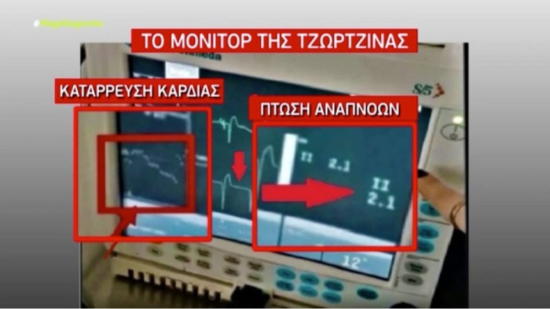 Η ώρα της αλήθειας για την υπόθεση της Πάτρας: Τί σημαίνουν οι ενδείξεις του μόνιτορ πριν τον θάνατο της Τζωρτζίνας (Video)